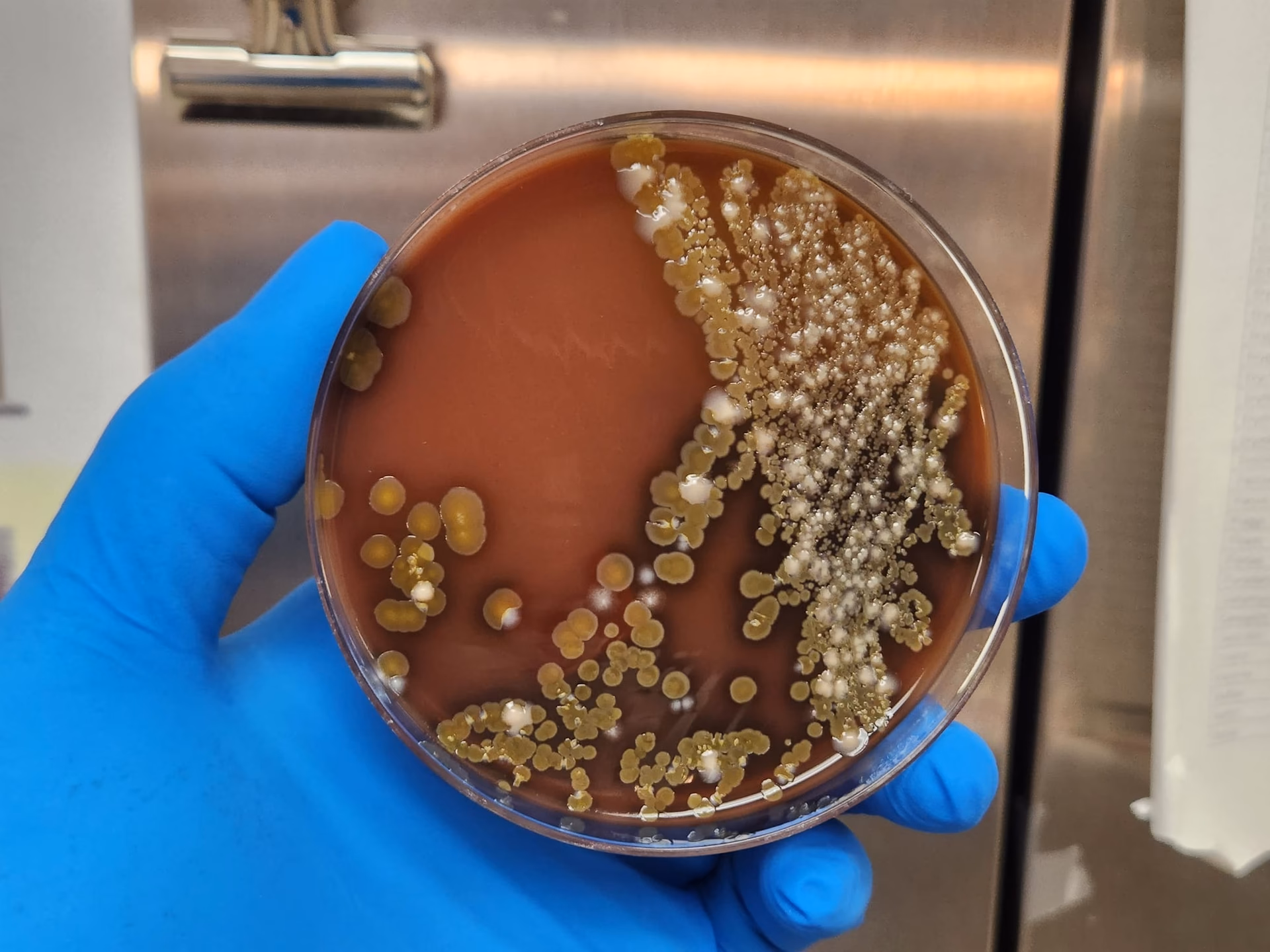 Does Acinetobacter baumannii cause nosocomial infections?