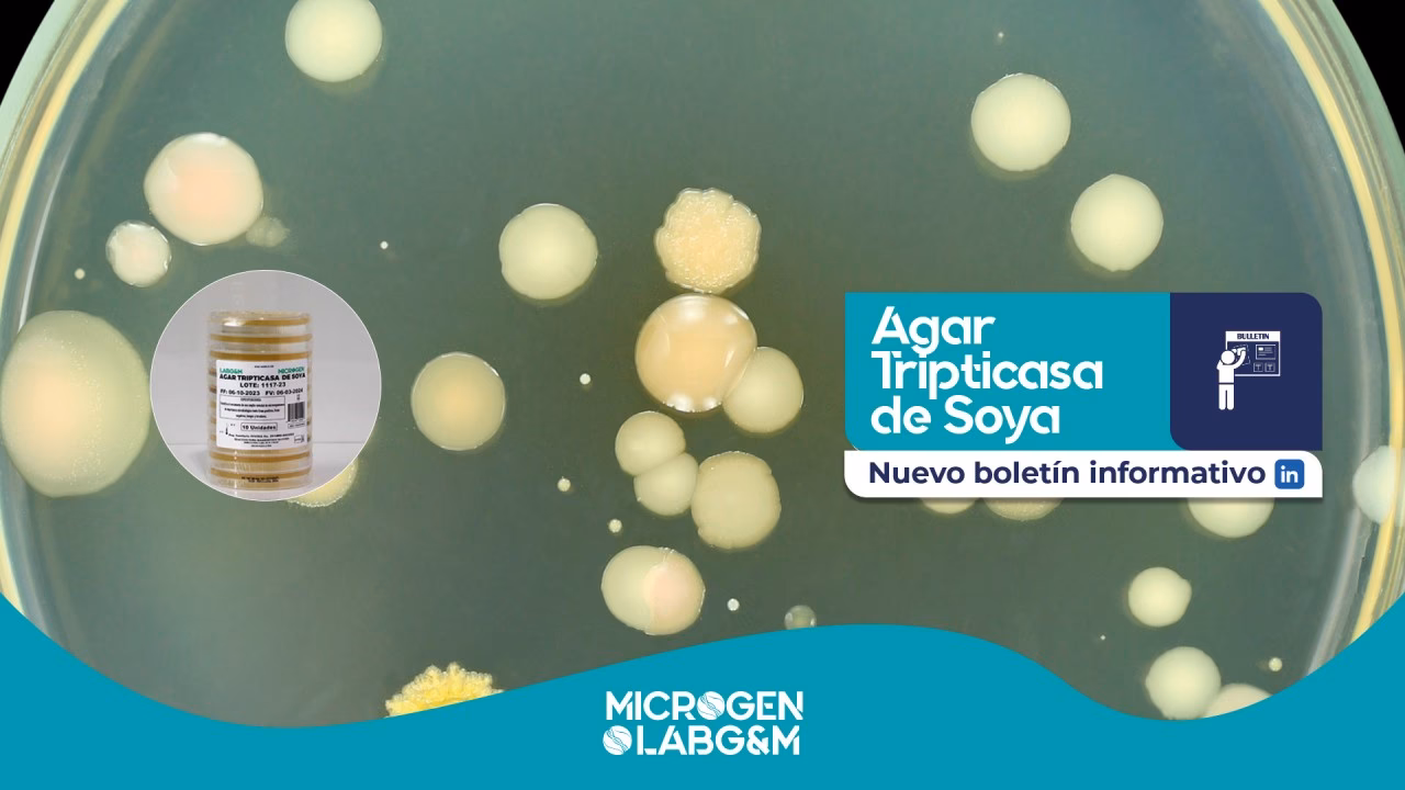 ¿Qué cepas se usan para estudiar el buen funcionamiento del agar soya tripticaseína?