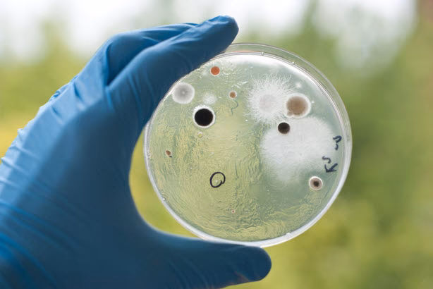 ¿Qué es el contaje de mesófilos aerobios?