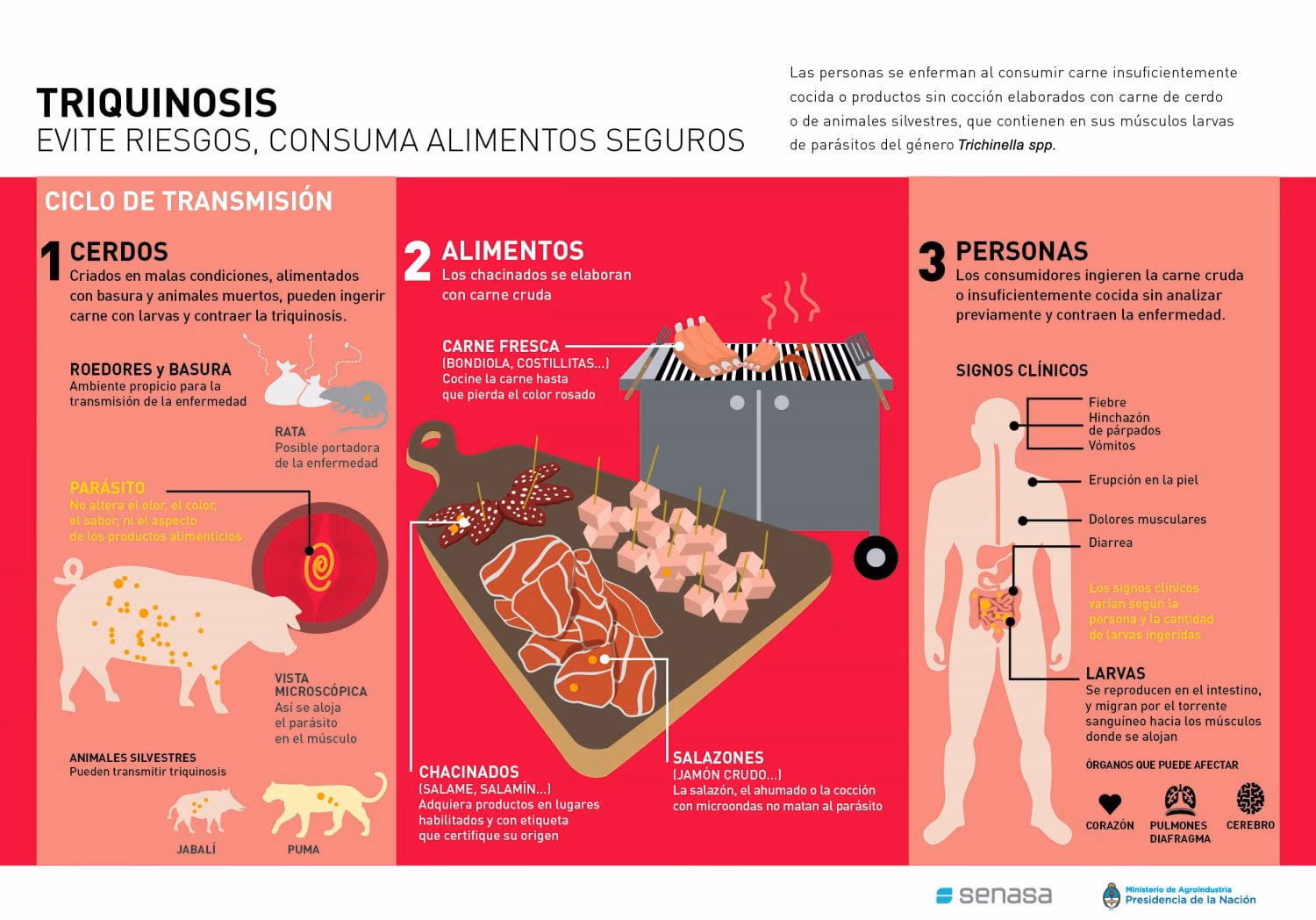 ¿Cuáles son los alimentos asociados con la triquinosis?