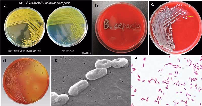 What is Burkholderia cenocepacia complex (Bcc)?