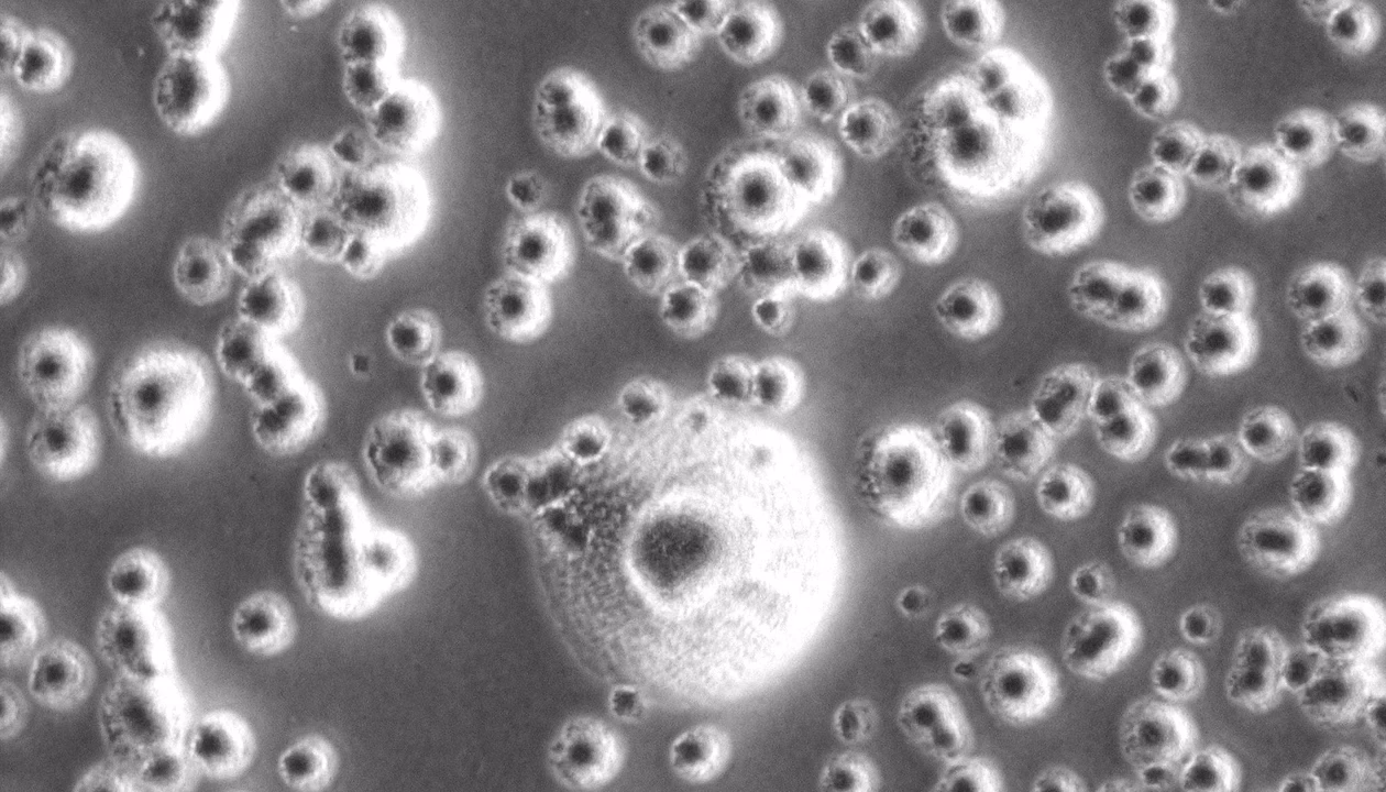 Why is microbial contamination a problem in cell culture?