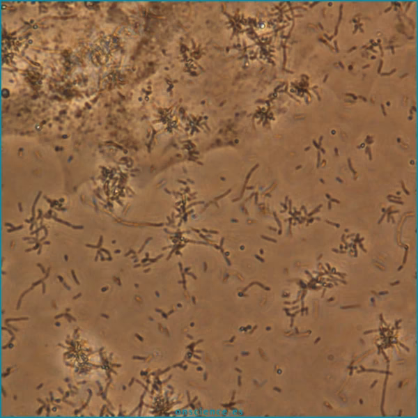 ¿Cuáles son las bacterias patógenas de los teléfonos celulares?