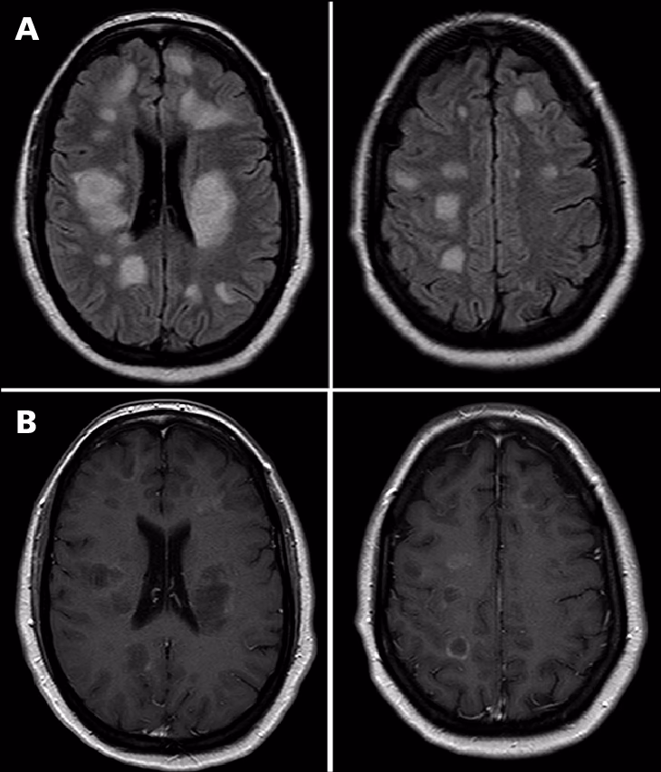 ¿Cómo llegar la contaminación al cerebro?