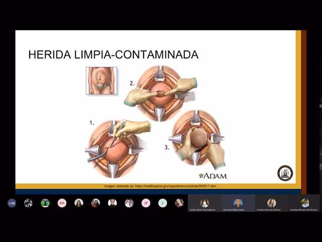 ¿Cuál es la importancia de las infecciones del espacio quirúrgico en la cirugía limpia?