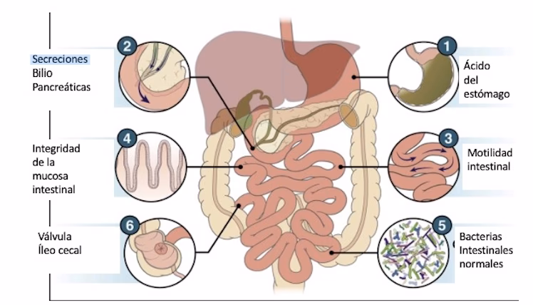 ¿Qué es una enfermedad intestinal?