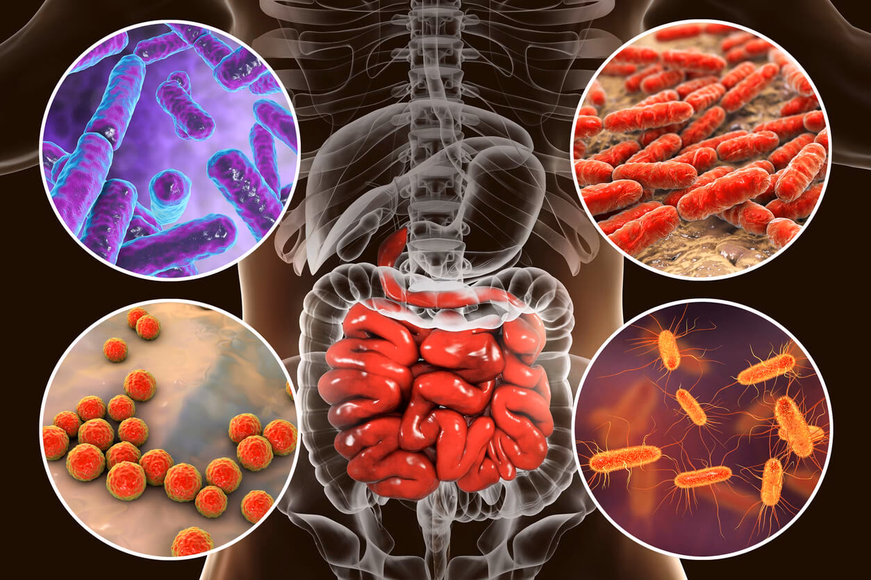 ¿Cómo prevenir la colonización excesiva de bacterias en el intestino delgado?