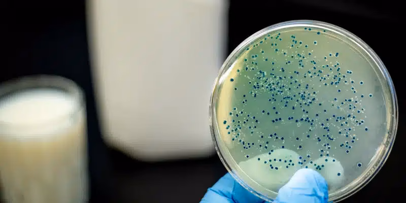 ¿Cuáles son los riesgos potenciales de los productos lácteos?