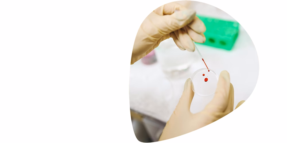 Is there a compensation scheme for the contaminated blood scandal?