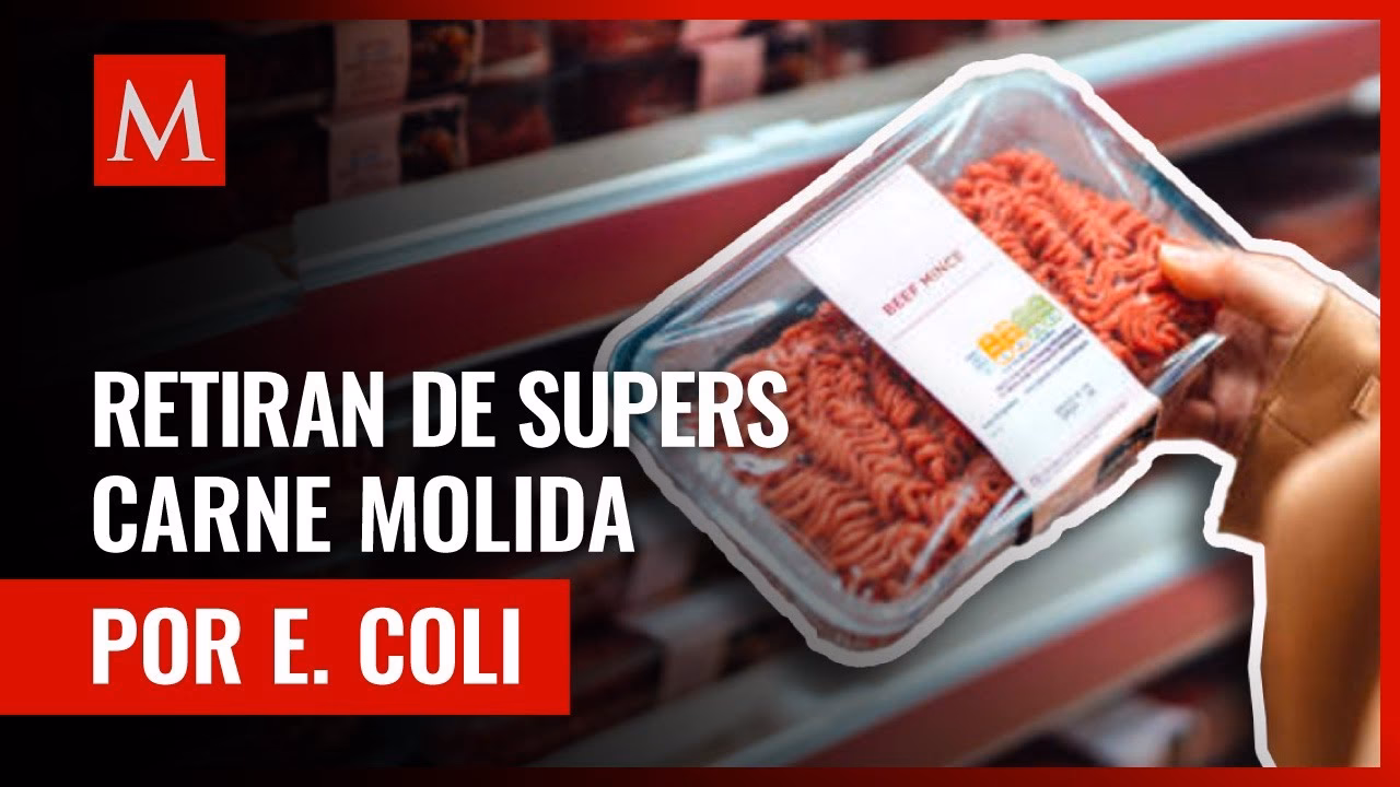 ¿Cuál es la ganancia de la Cooperativa Obrera?