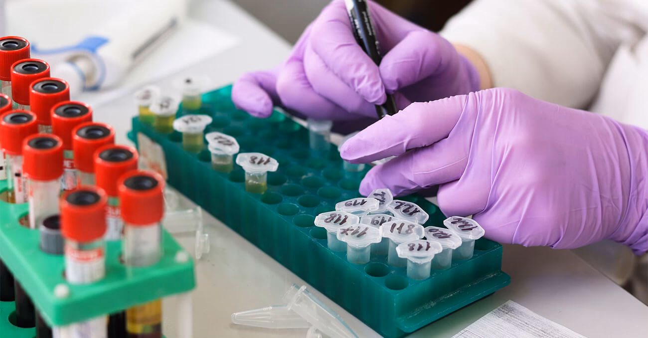 ¿Cómo saber si un laboratorio está contaminado?