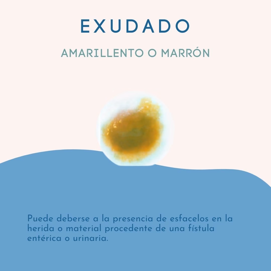 ¿Cómo se determina la presencia de estafilococos en la sangre?