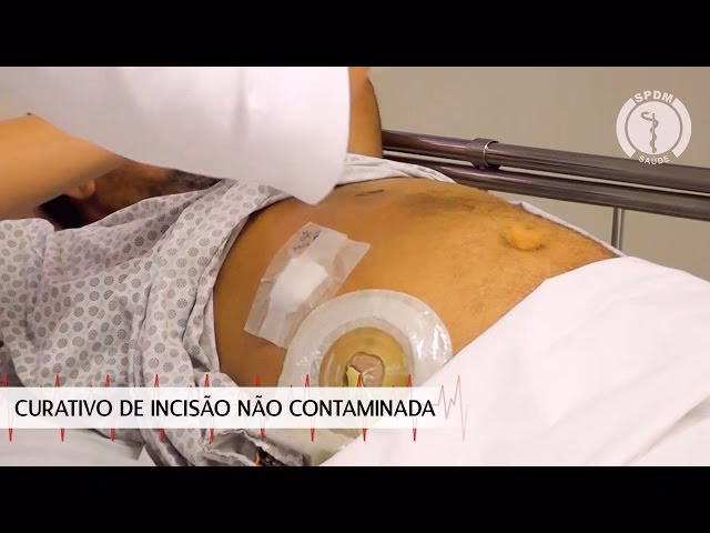 Como fazer um bom curativo?