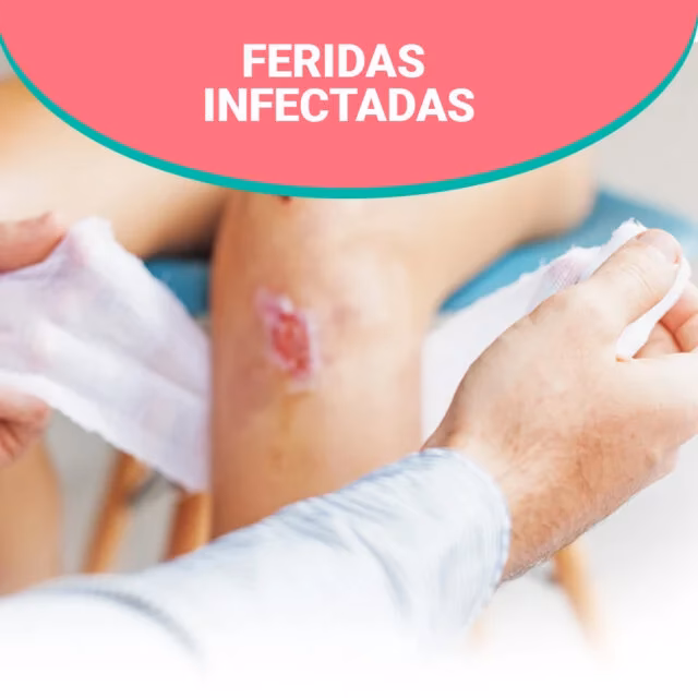 O que é curativo e para que serve?