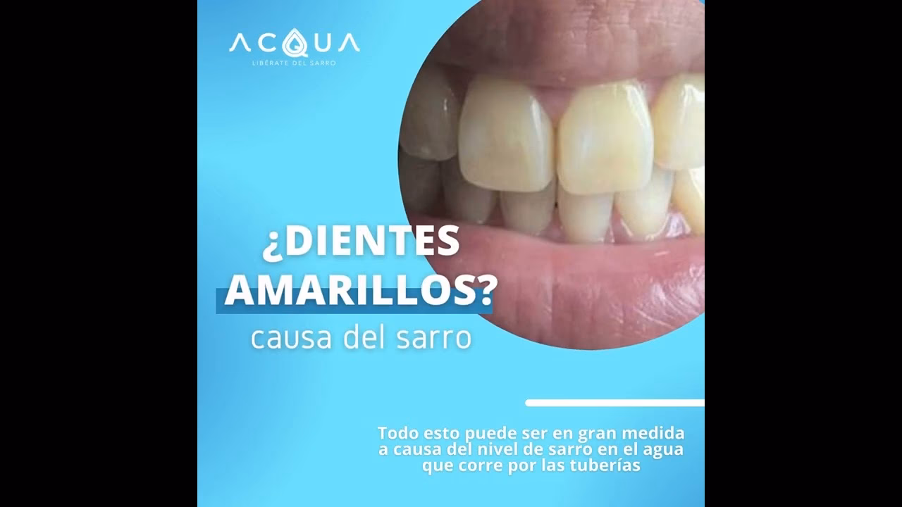 ¿Cuál es el impacto ambiental de lavarse los dientes?