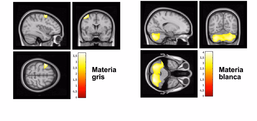 ¿Cómo influye el entorno en el desarrollo del sistema neuronal?