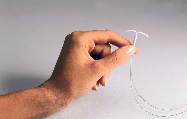 ¿Qué es el DIU de cobre y para qué sirve?