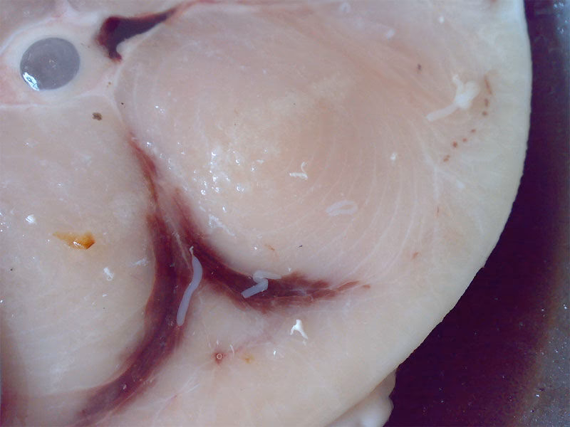 ¿Cuál es el impacto de los parásitos en la salud pública?