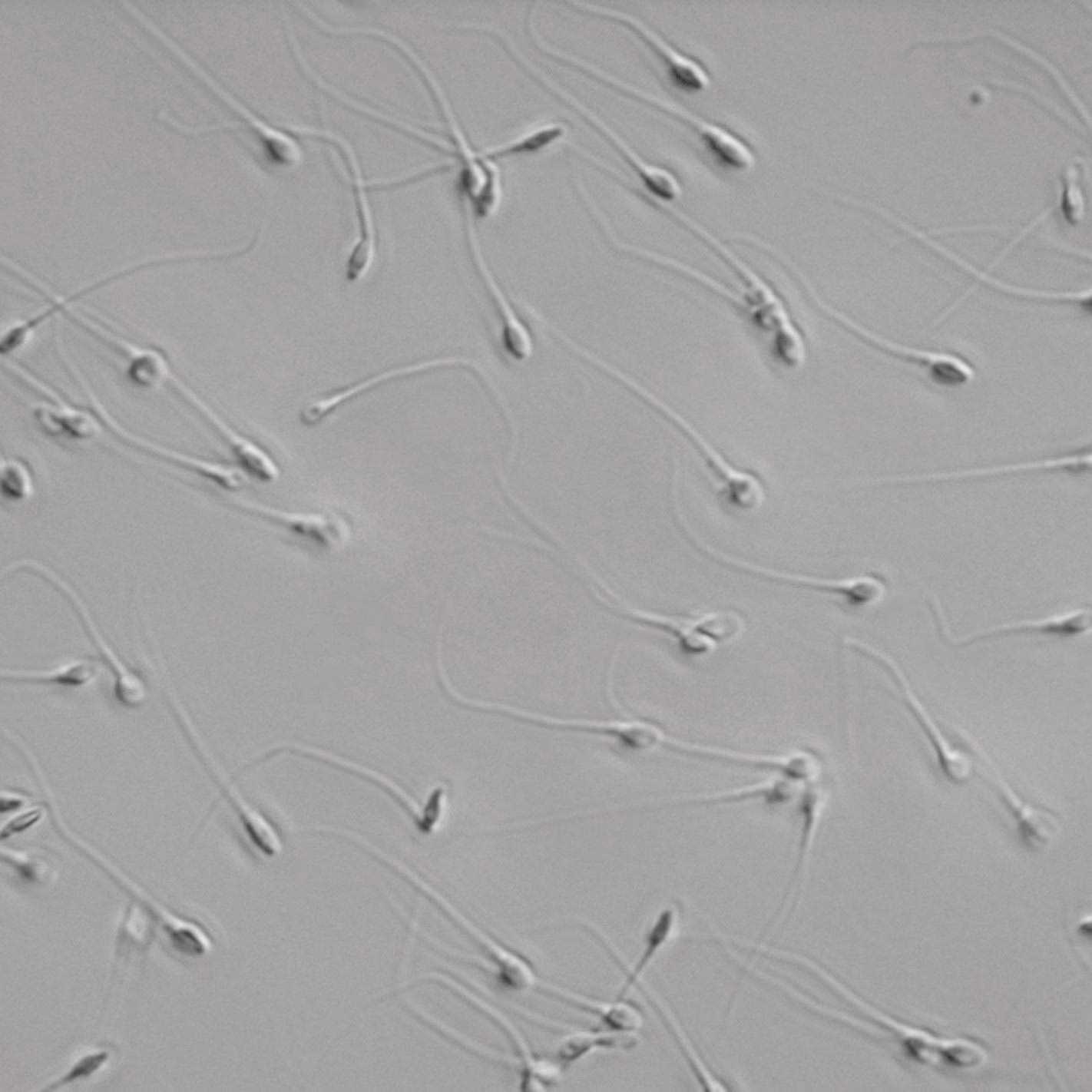 ¿Cómo se recubrió el aglomerado de espermatozoides?