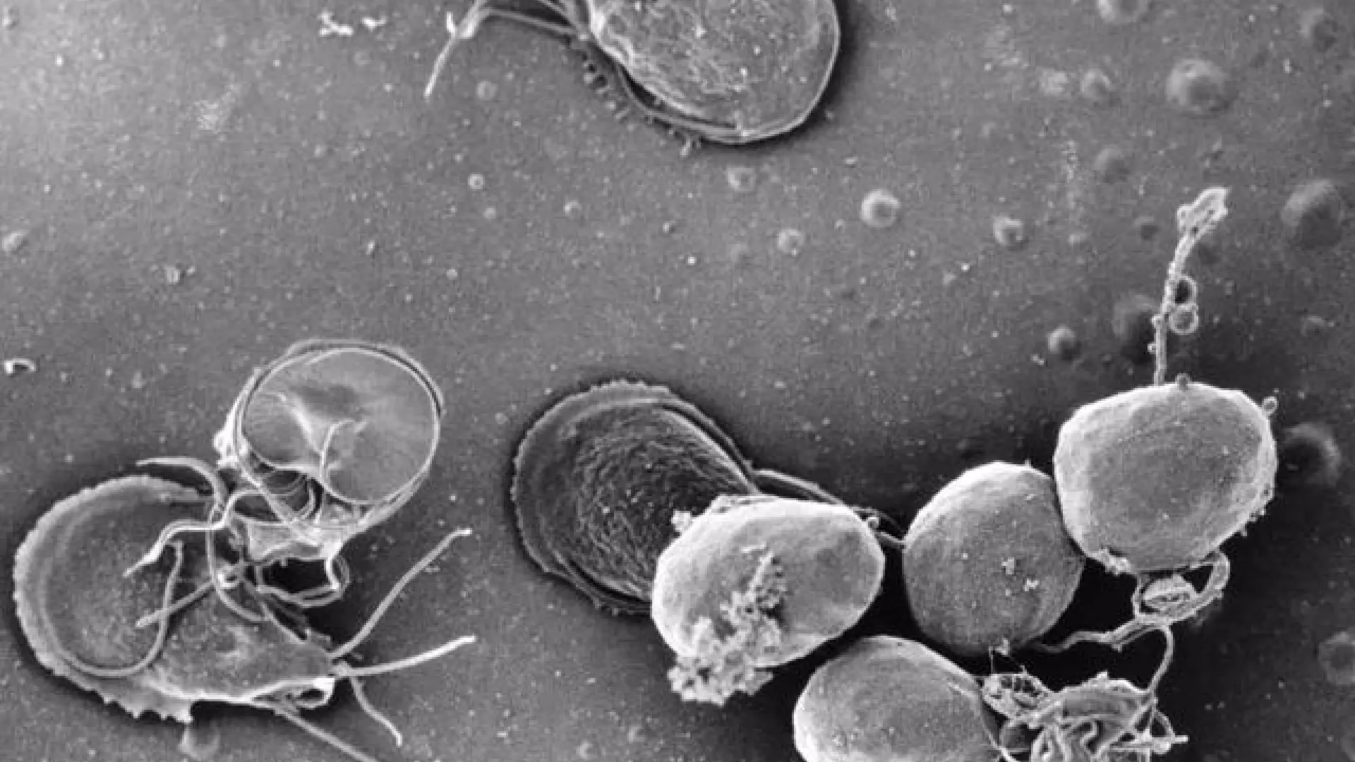 ¿Cómo se desinfecta el ambiente para prevenir la giardiasis?