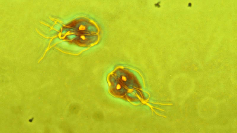 ¿Cómo se desinfecta el ambiente para prevenir la giardiasis?