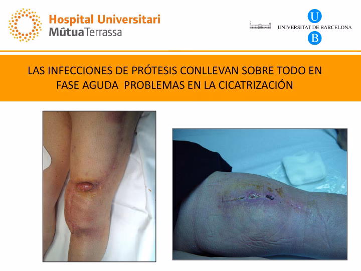 ¿Qué se recomienda para la higiene corporal del paciente con heridas o drenajes?