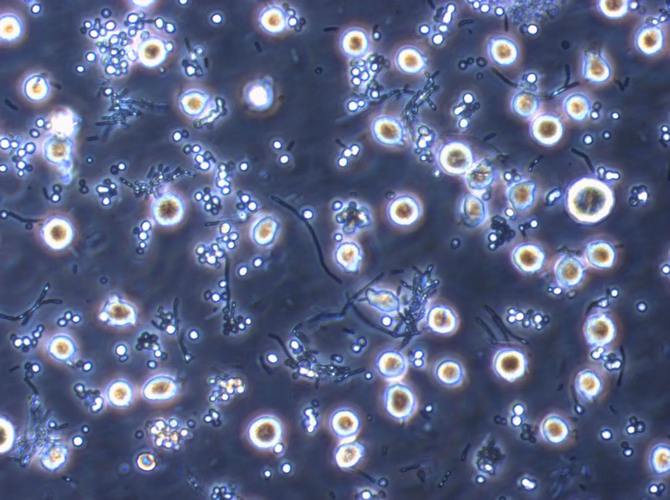 Can hyphae be detected by the naked eye?