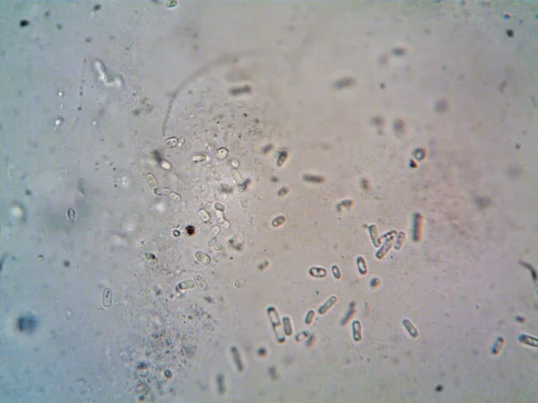 ¿Cuál es el efecto de la eliminación de agua en el microscopio electrónico de barrido?