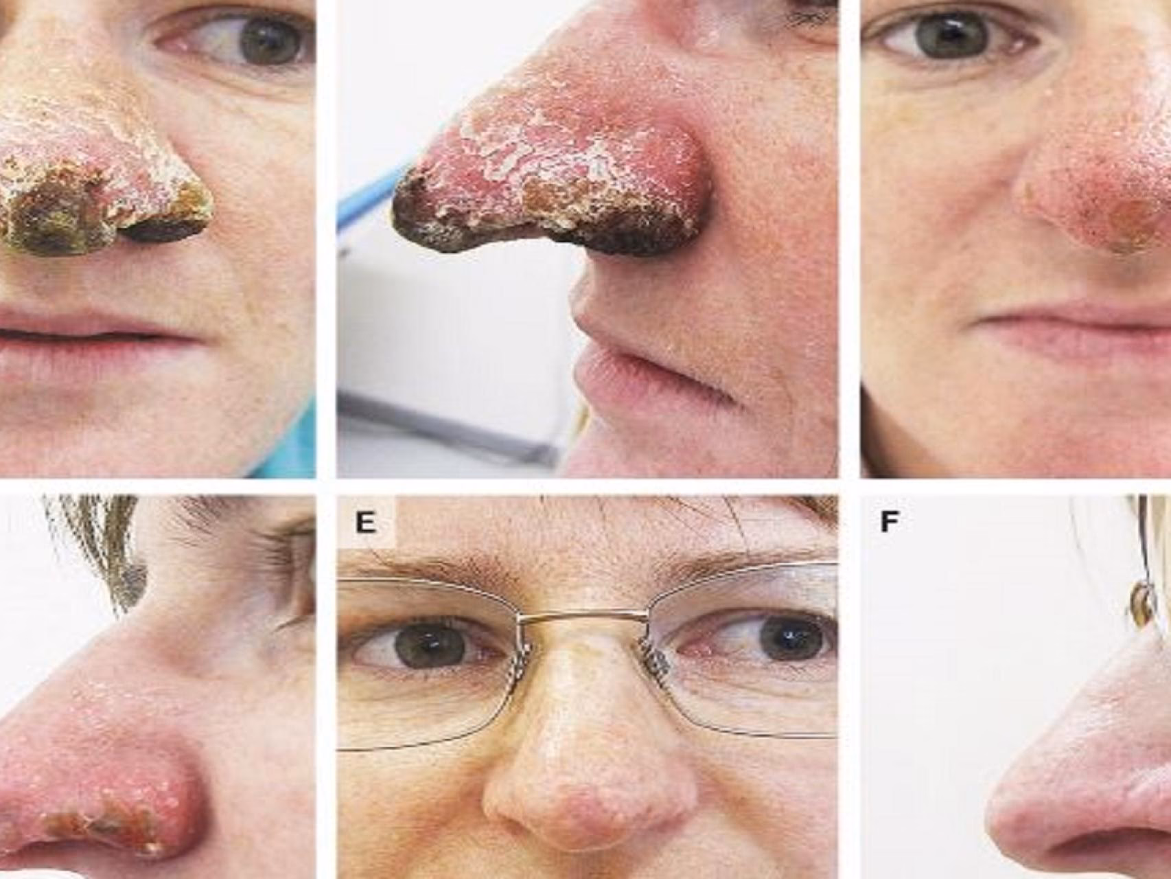 ¿Cuáles son los contaminantes que afectan la nariz?