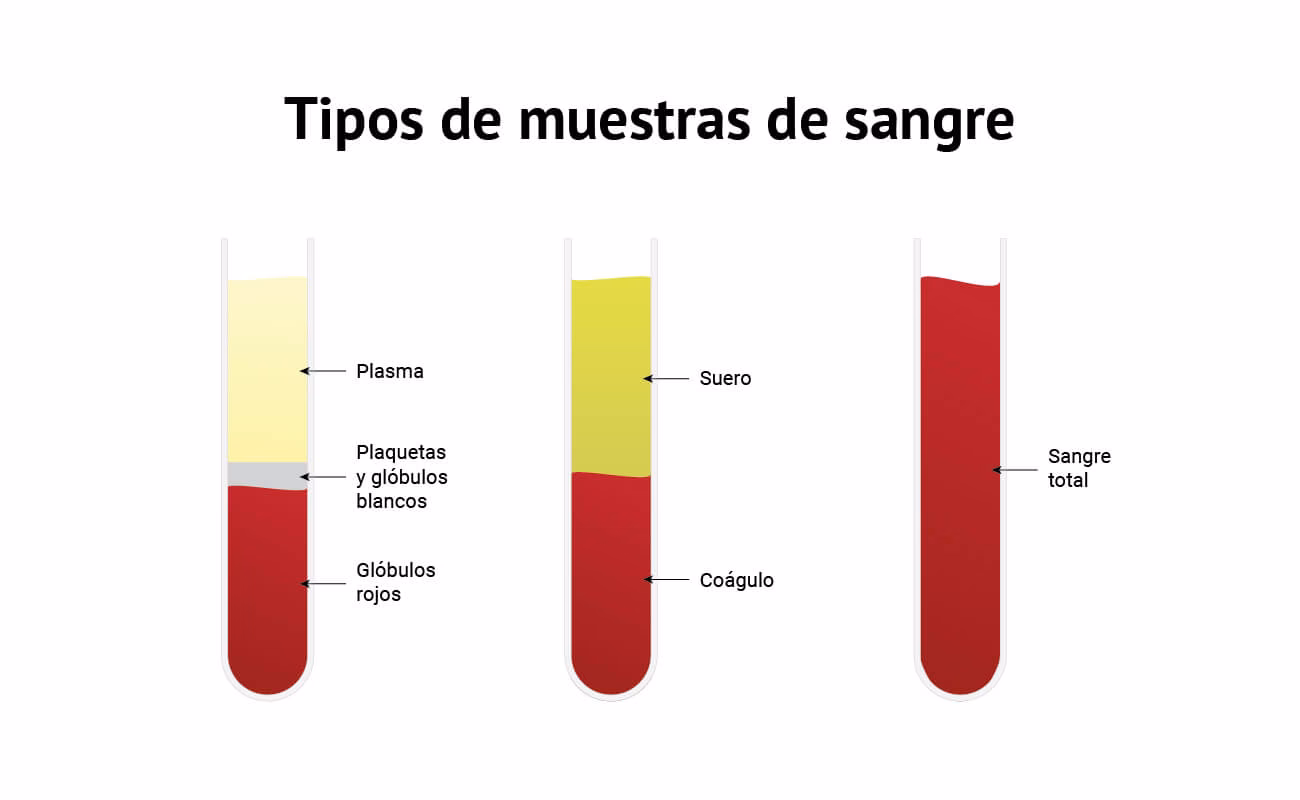 ¿Qué pasa si centrifugas la sangre demasiado pronto?