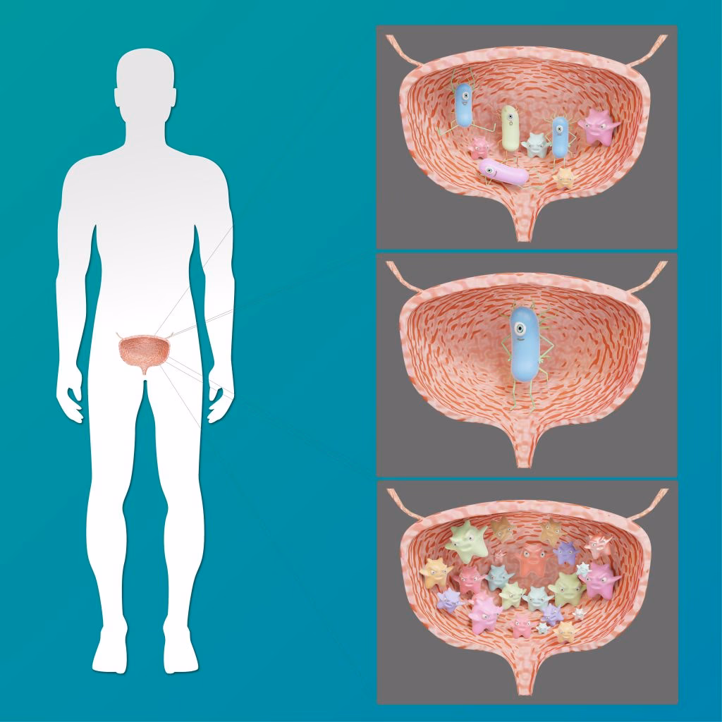 ¿Qué residuos se expulsan al orinar?