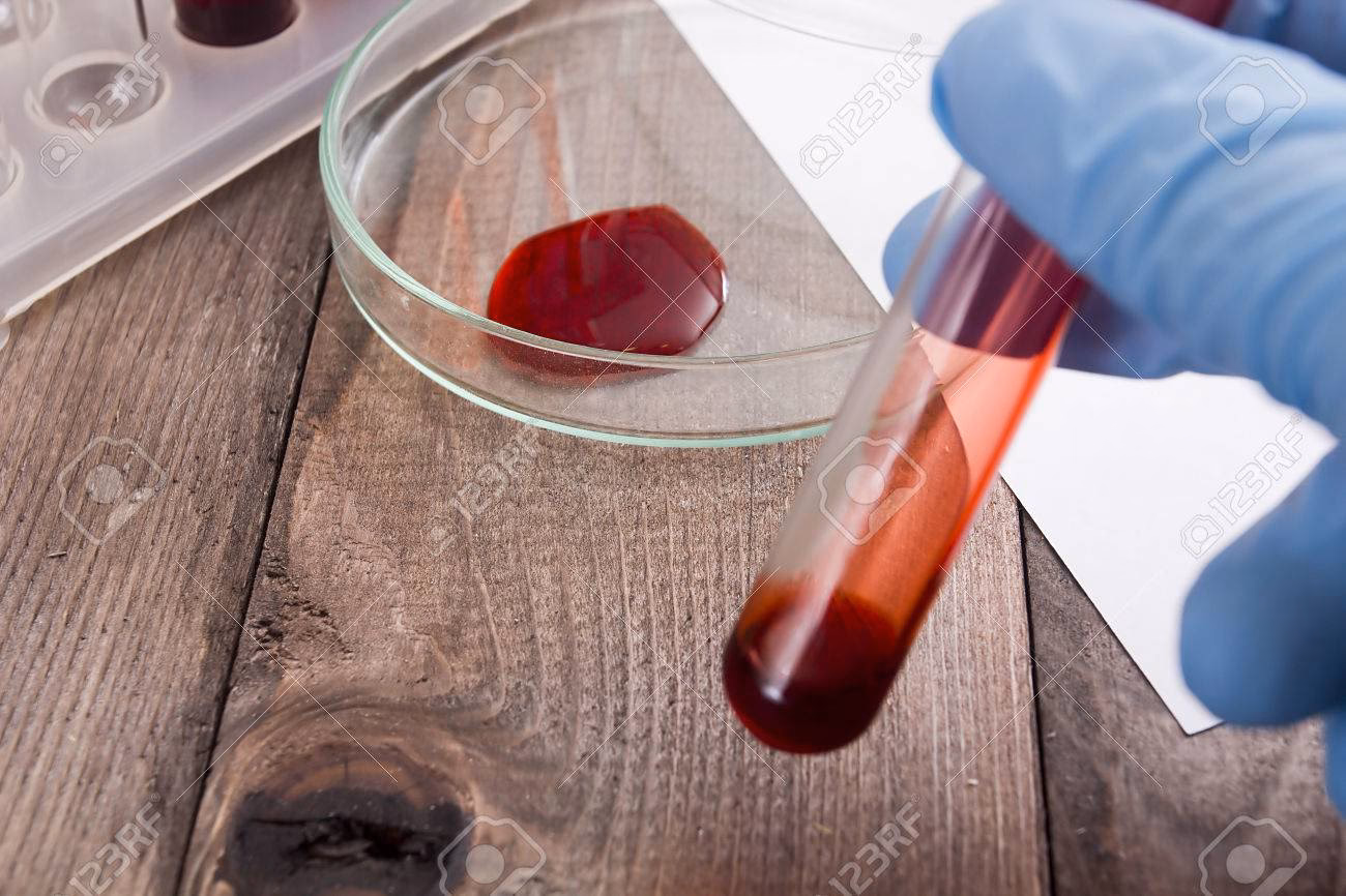 ¿Cuáles son los contaminantes de la sangre?