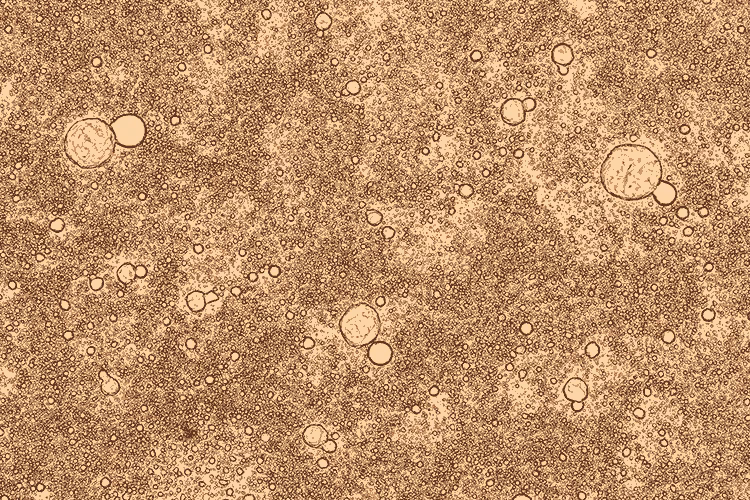 ¿Cómo evitar la contaminación bacteriana en la leche materna?