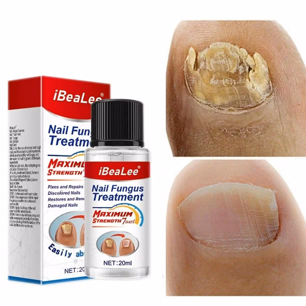 ¿Cómo prevenir los riesgos de los kits caseros de uñas en gel?