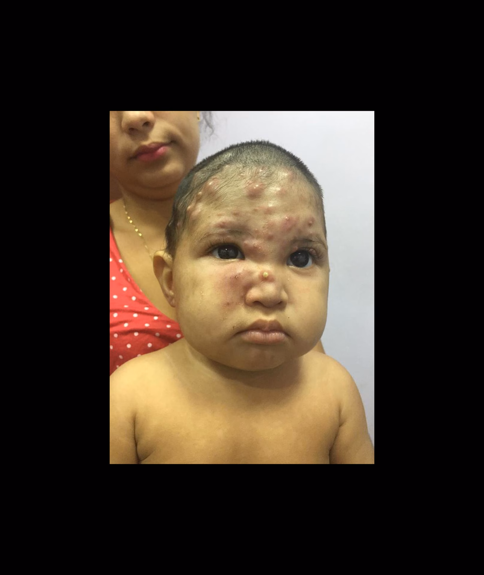 ¿Cómo reducir el impacto de la contaminación en la salud humana?