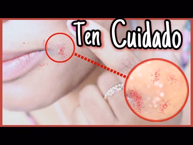 ¿Cómo puedo saber si un brote está contaminado?