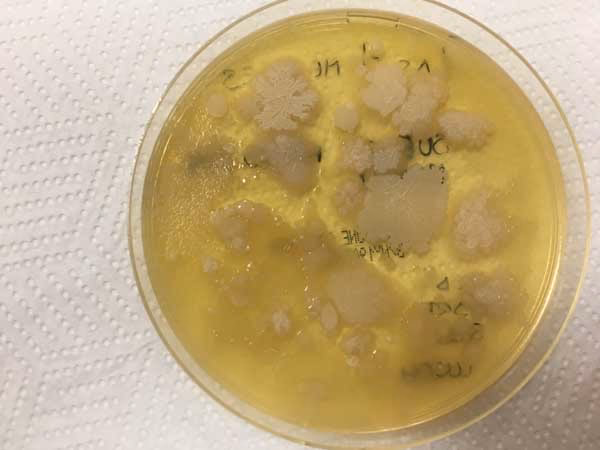 ¿Cómo se preparan los medios de cultivo?