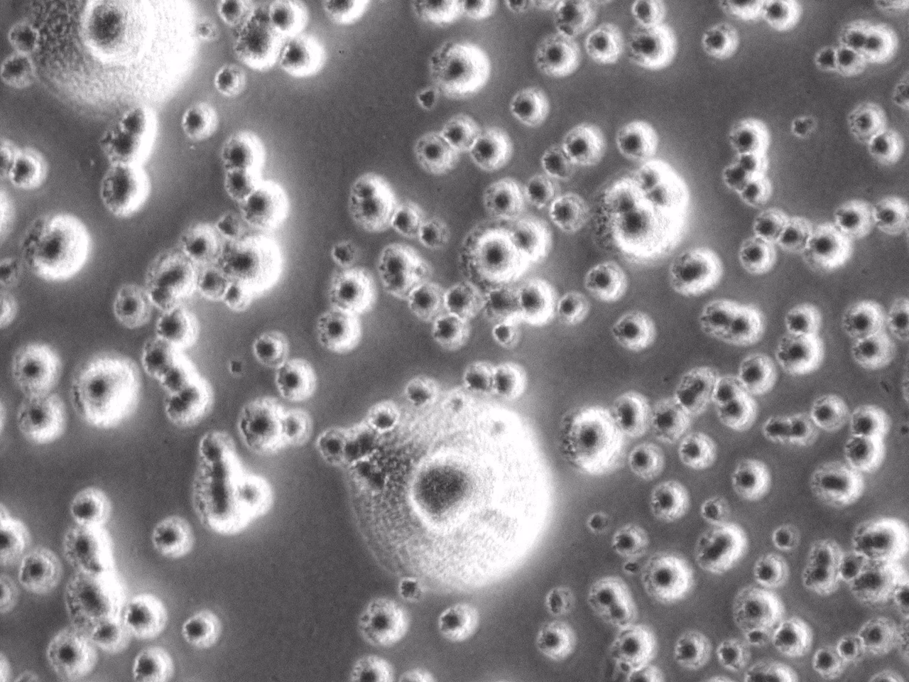 How often should I use Mycoplasma in primary culture?