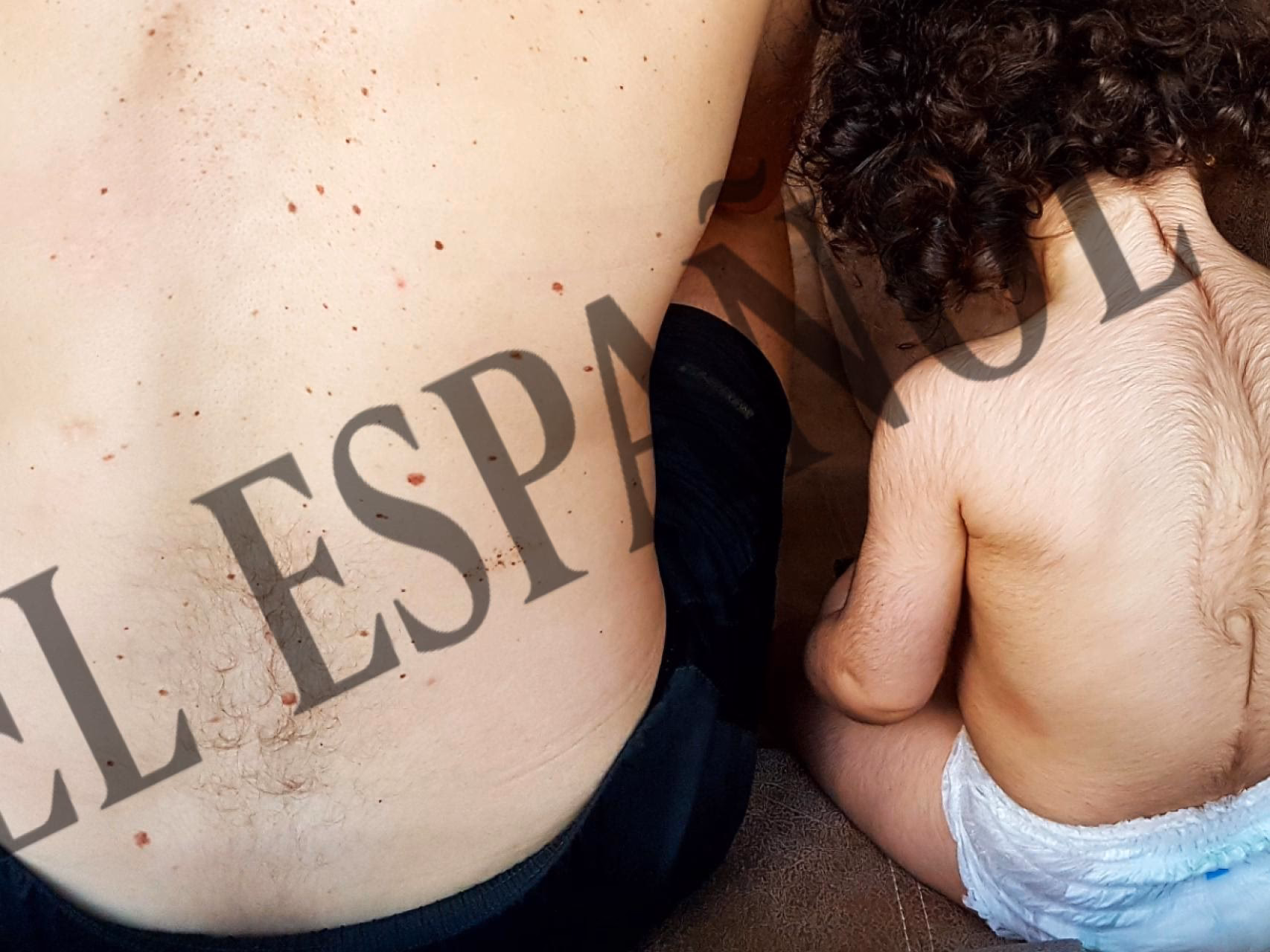 ¿Cómo se reconstituye el omeprazol?