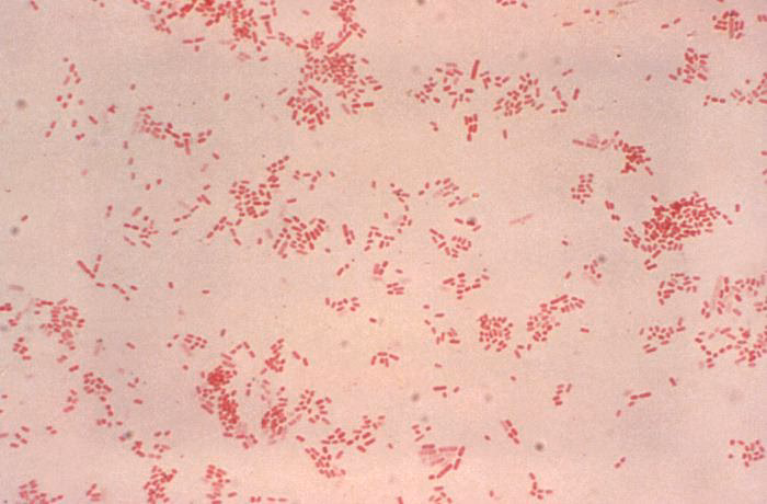 ¿Cómo se puede contraer la bacteria Pasteurella multocida?