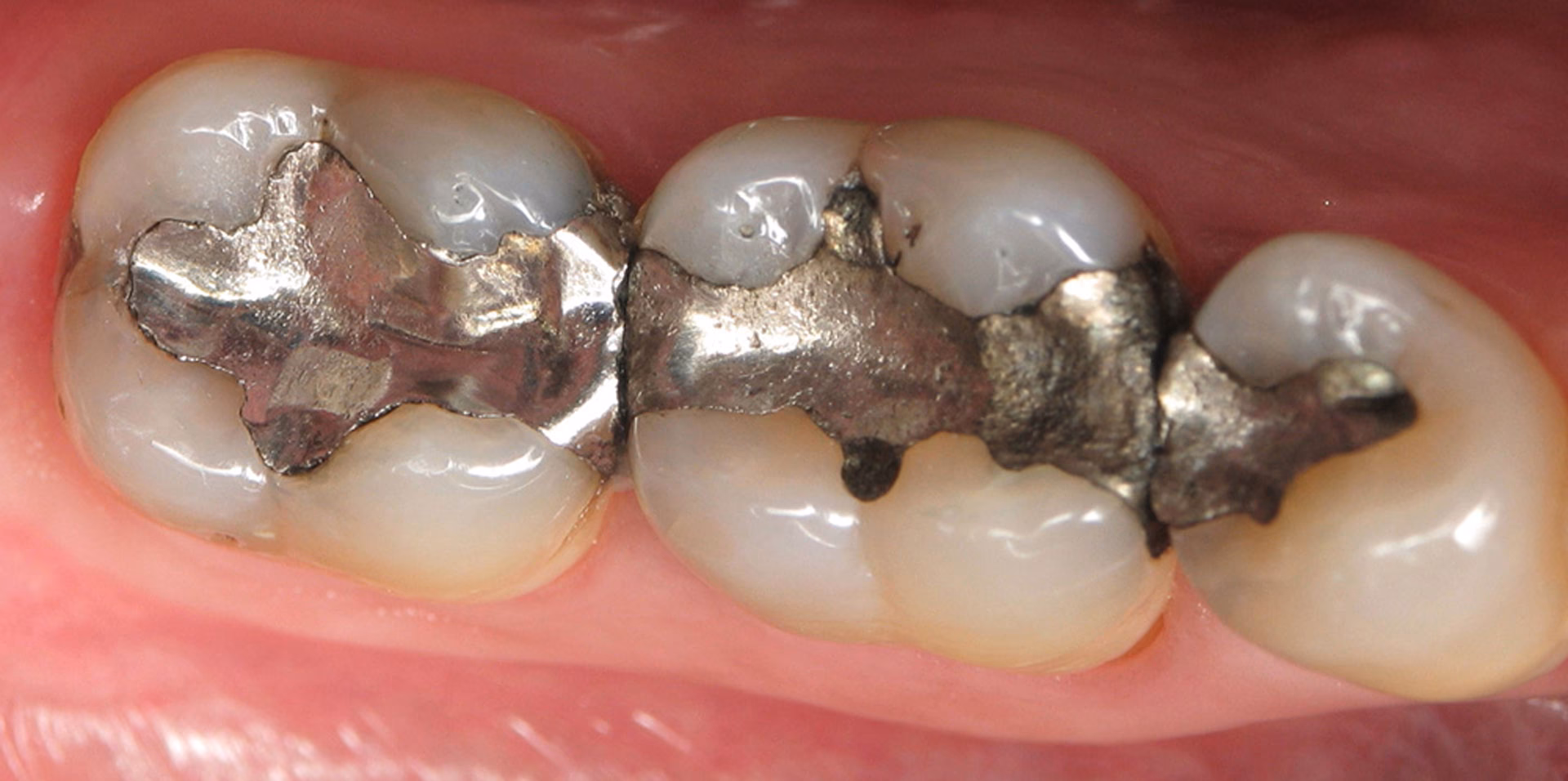 ¿Qué son las aleaciones metálicas?