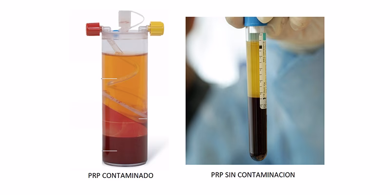 ¿Cómo afecta la contaminación a las plaquetas blancas?