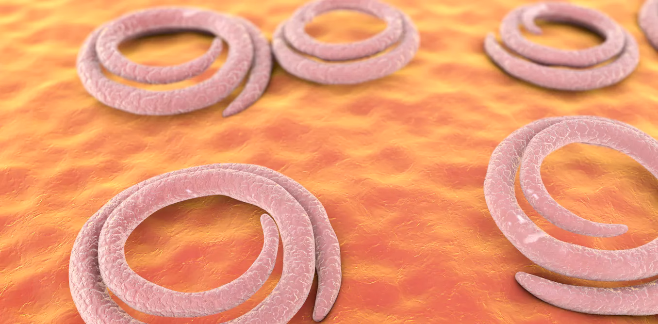 ¿Cuáles son las causas de la triquinosis?