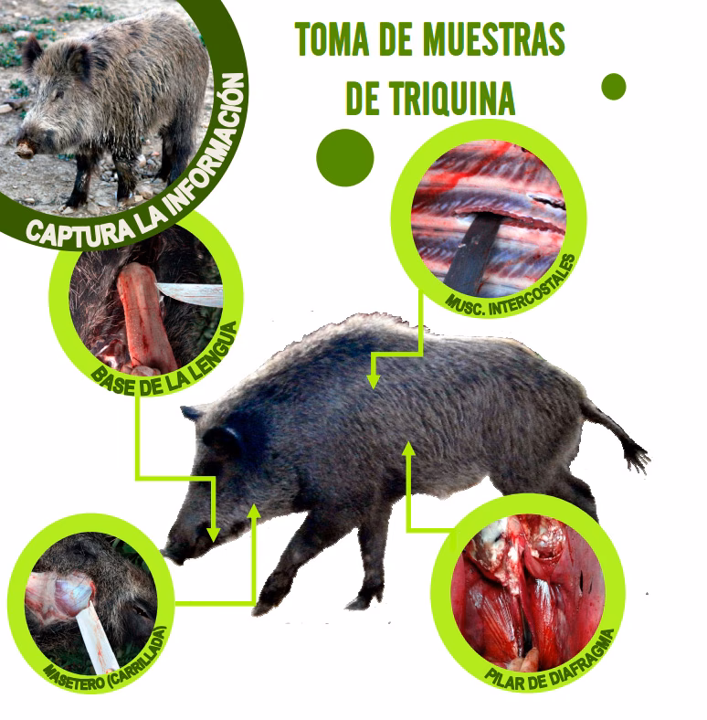 ¿Cuáles son las causas de la triquinosis?