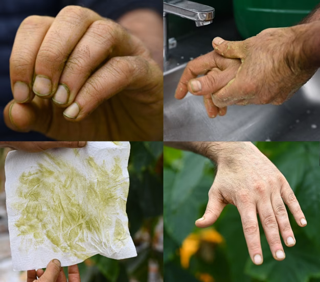 ¿Qué es un esguince del pulgar?