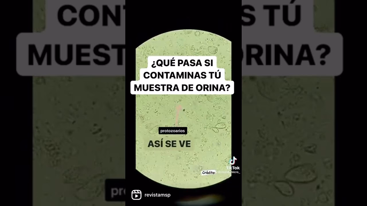 ¿Qué medicamentos pueden afectar la frecuencia con la que orinas?