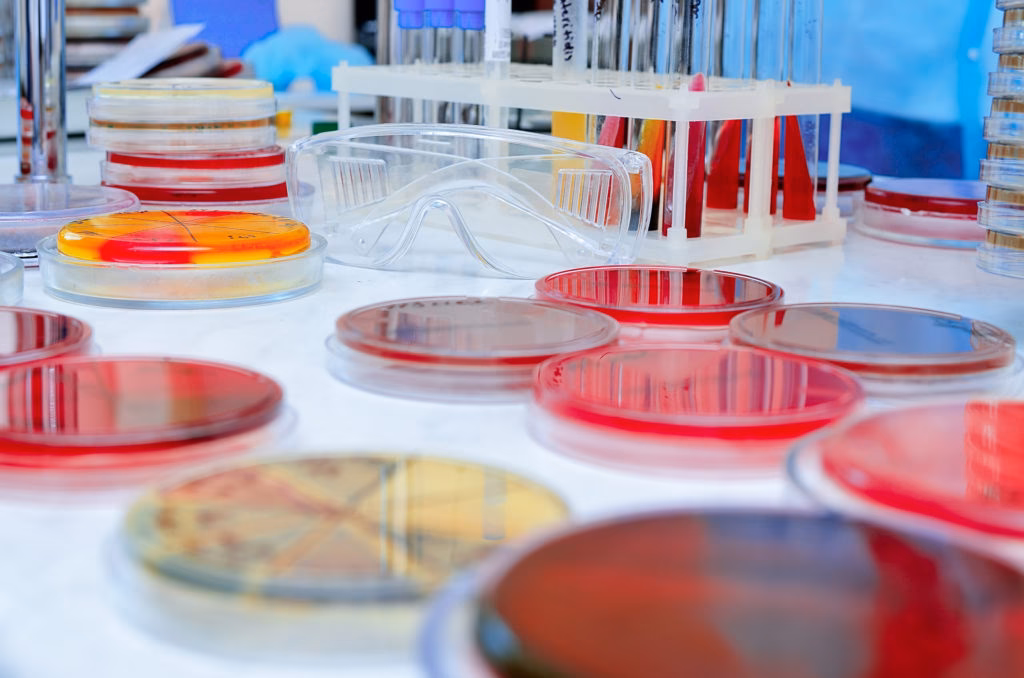 ¿Cómo se pueden contaminar las muestras?