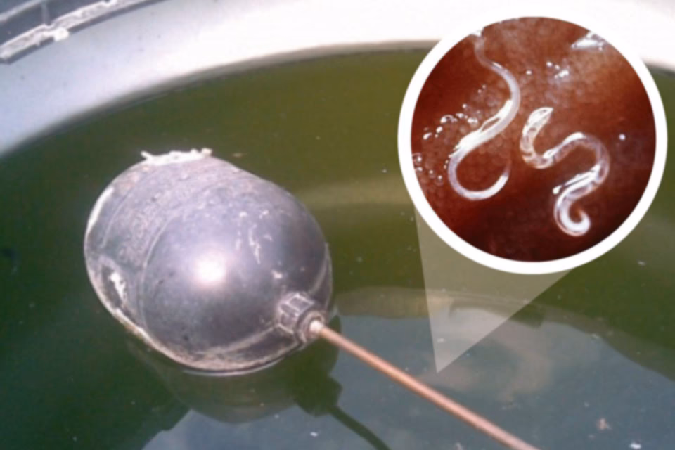 ¿Cómo afecta el sarro a la salud?