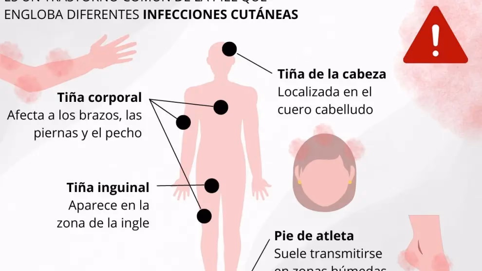 ¿Cuáles son las causas de la contaminación?