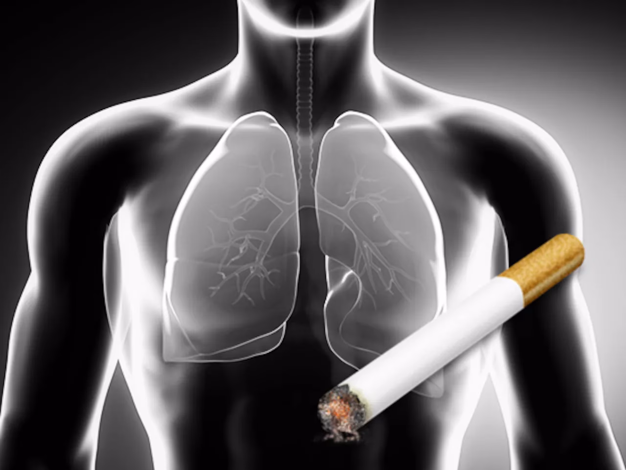 ¿Qué pasa si dejo de fumar y tengo cáncer pulmonar?